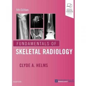 Fundamentals of Skeletal Radiology