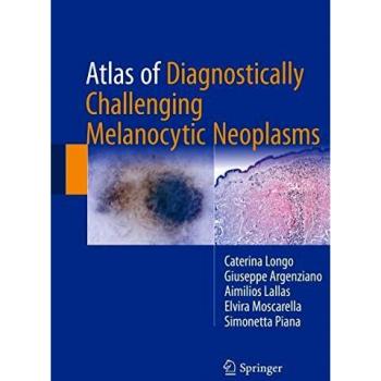 Atlas of Diagnostically Challenging Melanocytic Neoplasms