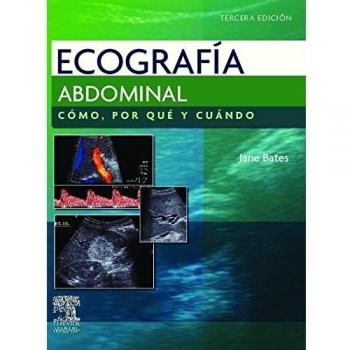 Ecografía abdominal. Cómo, por qué y cuándo