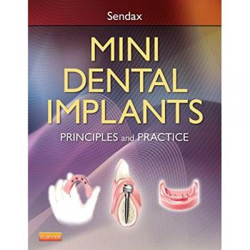 Mini Dental Implants: Comprehensive Guide and Best Practices