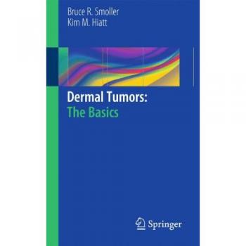 Dermal Tumors: The Basics