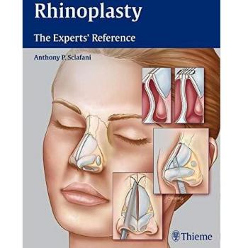 Rhinoplasty: The Experts' Reference
