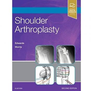 Shoulder Arthroplasty, 2e