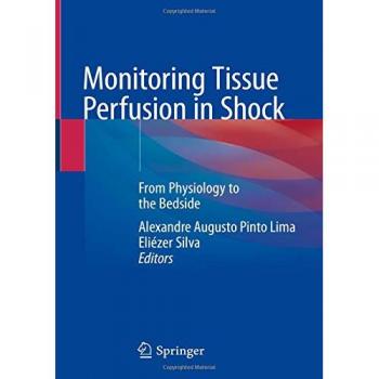 Monitoring Tissue Perfusion in Shock: From Physiology to the Bedside