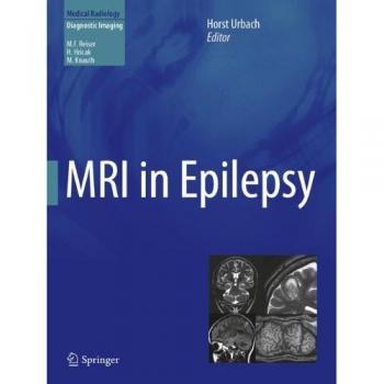 MRI in Epilepsy