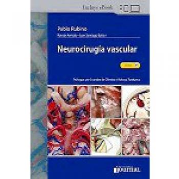 NEUROCIRUGIA VASCULAR