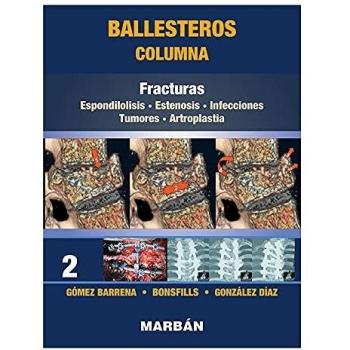COLUMNA 2. FRACTURAS.