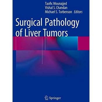 Surgical Pathology of Liver Tumors