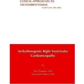 Arrhythmogenic Right Ventricular Cardiomyopathy