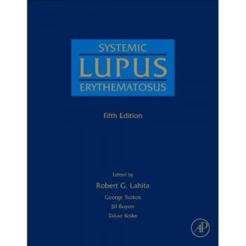 Systemic Lupus Erythematosus (Hardback) by Academic Press, Inc