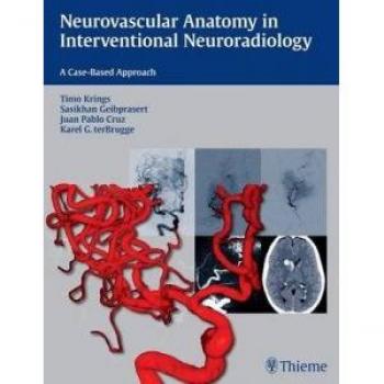 Neurovascular Anatomy Guide for Interventional Neuroradiology