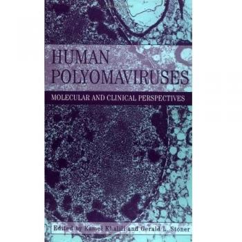 Human Polyomaviruses: Molecular and Clinical Perspectives
