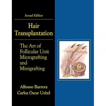 Hair Transplantation: The Art of Micrografting and Minigrafting