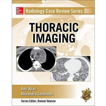 Radiology Case Review Series: Thoracic Imaging