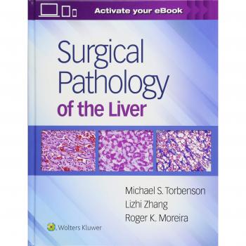 Surgical Pathology Of The Liver