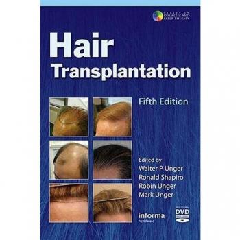 Hair Transplantation