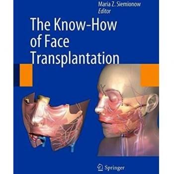 The Know-How of Face Transplantation