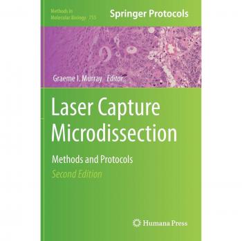 Laser Capture Microdissection: Methods and Protocols