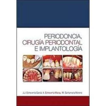 Periodoncia cirugia periodontal e implantologia