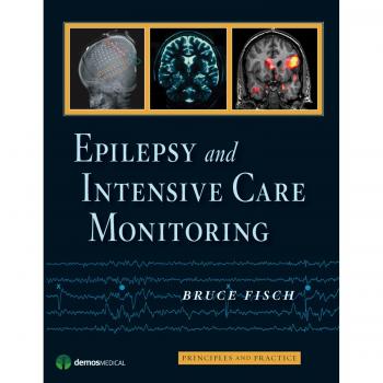 Epilepsy Intensive Care Monitoring Handbook: Principles and Practice