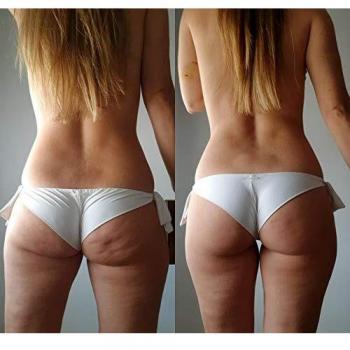 Valy Cosmetics Ion Patch Reducer El primer parche reductor con MESOTERAPIA NO INVASIVA 56 parches