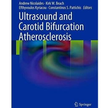 Ultrasound and Carotid Bifurcation Atherosclerosis
