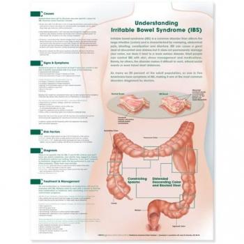 Entender Irritable Bowel Síndrome Anatómico Gráfico