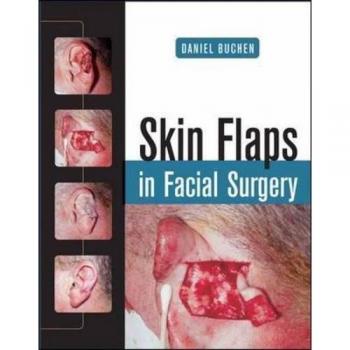 Skin Flaps in Facial Surgery
