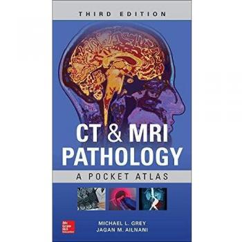CT & MRI Pathology Pocket Atlas: Third Edition by Jagan Ailinani