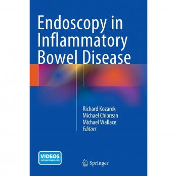 Inflammatory Bowel Disease Endoscopy Guide