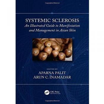 Systemic Sclerosis: An Illustrated Guide to Manifestation and Management in Asian Skin