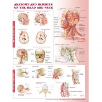 Anatomía y lesiones de la cabeza y el cuello Tabla anatómica