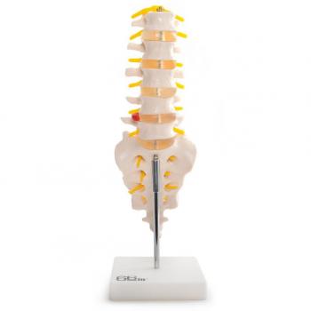 66Fit  Lumbar vertebrae with Sacrum/Coccyx/herniated Disco