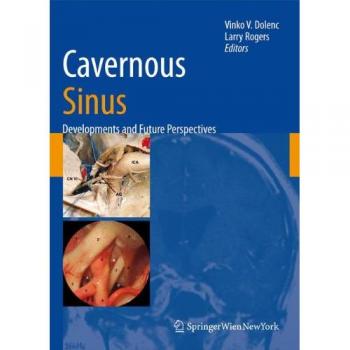 Cavernous Sinus: Advances and Future Outlook