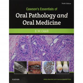 Cawson's Essentials of Oral Pathology and Oral Medicine, 9th Edition