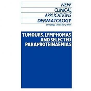 Tumours, Lymphomas and Selected Paraproteinaemias: 7