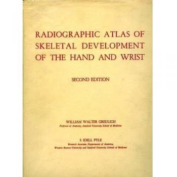 Radiographic Atlas of Hand and Wrist Skeletal Development by William Greulich