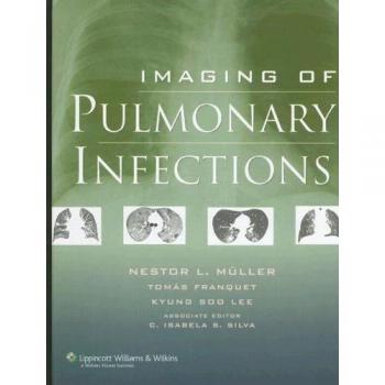 Imaging of Pulmonary Infections