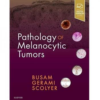 Pathology of Melanocytic Tumors, 1e