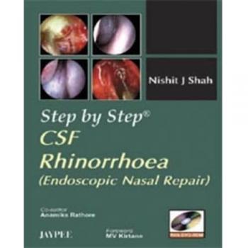 Step by Step: CSF Rhinorrhoea: Endoscopic Nasal Repair
