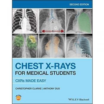 Clarke C Chest XRays for Medical Students