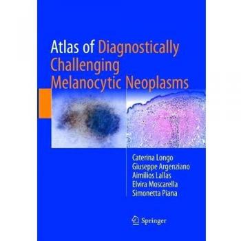 Atlas of Diagnostically Challenging Melanocytic Neoplasms