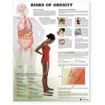 Risks of Obesity - Tabla anatómica