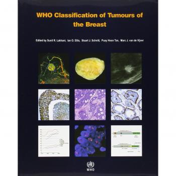 WHO classification of tumours of the breast