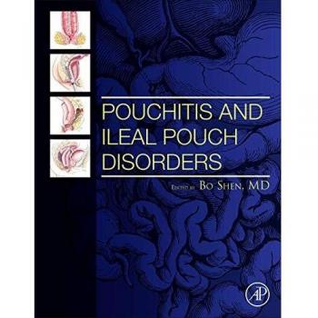 Pouchitis and Ileal Pouch Disorders: A Multidisciplinary Approach for Diagnosis and Management