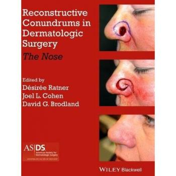 Dermatologic Surgery Reconstructive Challenges: The Nose Edition