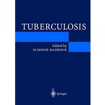 Tuberculosis