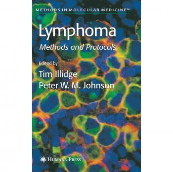Lymphoma: Methods and Protocols