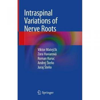 Intraspinal Variations of Nerve Roots