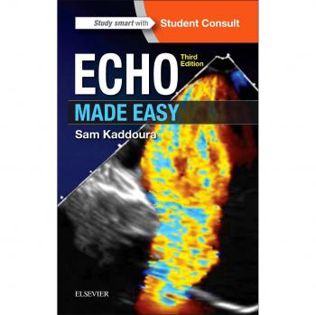 Echo Made Easy, 3e
